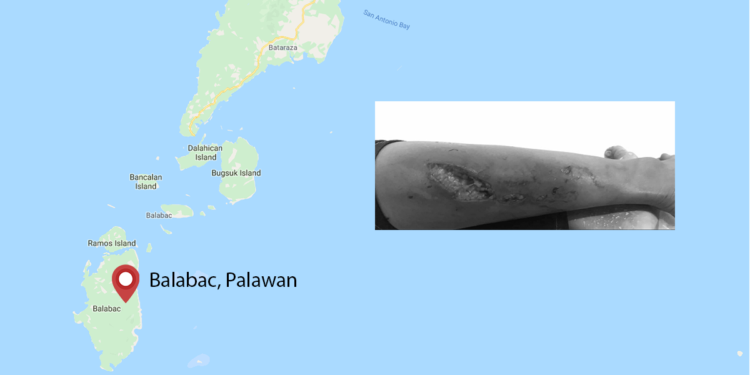 12-anyos na batang babae sa Balabac, iniligtas ng kapatid