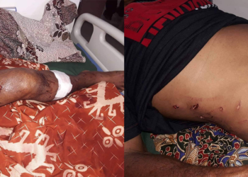 Mangingisda, nakaligtas matapos atakihin ng buwaya sa Bataraza