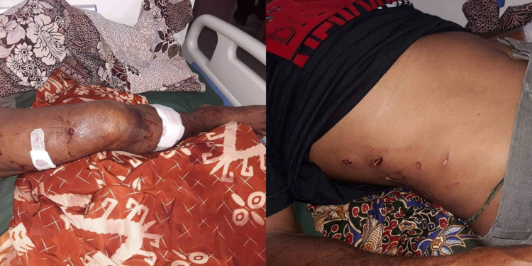 Mangingisda, nakaligtas matapos atakihin ng buwaya sa Bataraza