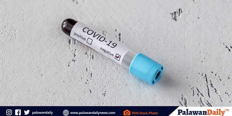 Confirmatory test ng isang indibidwal na umuwi sa lungsod lulan ng eroplano ni Gov. JCA, negatibo ang resulta