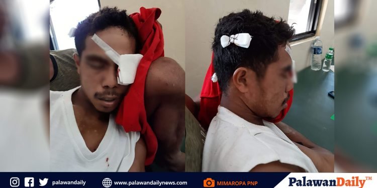 Lalaking nangingisda, inatake ng buwaya sa Balabac