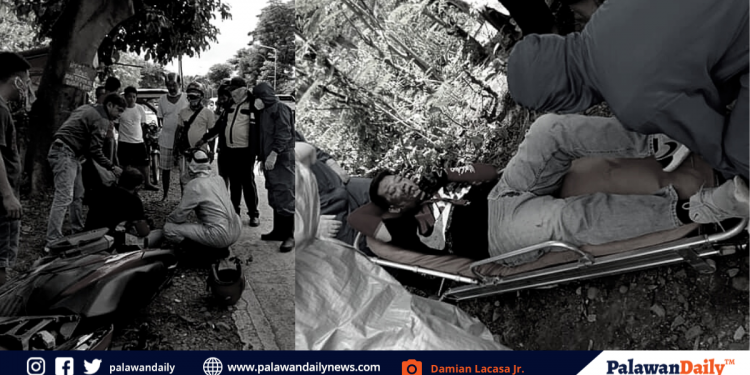 Lalaki, sugatan matapos aksidenteng bumangga sa puno ang sinasakyang motor