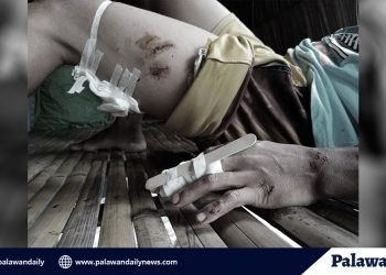 Lalaki sa Balabac, nakaligtas matapos makipag-bunuan sa buwaya