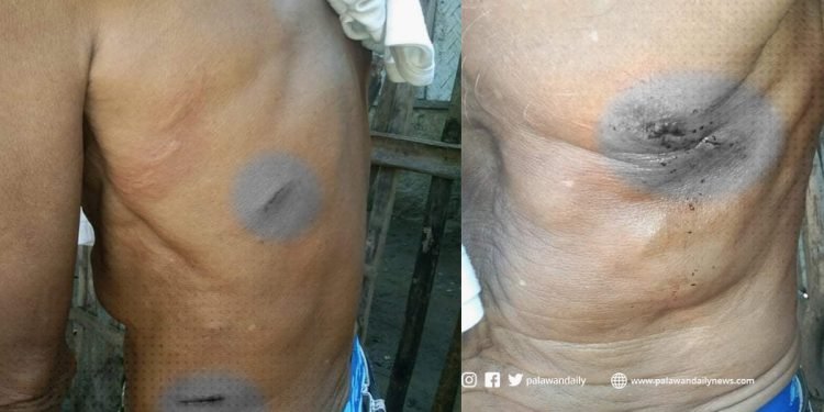 Naningil ng utang sa bayan ng Narra, binugbog