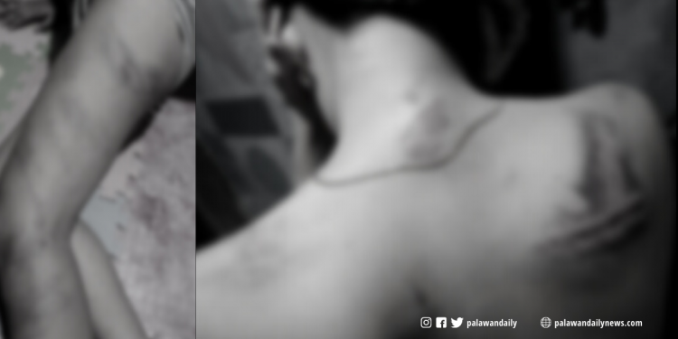 Koreano, pinaghahampas ng golf stick ang kanyang live-in partner na Palaweña