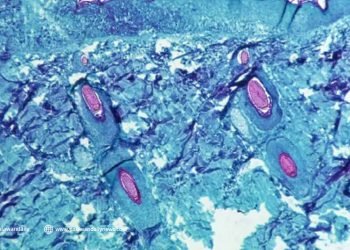 With the rising cases of ‘Monkeypox’, could this possibly be another pandemic?