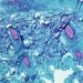With the rising cases of ‘Monkeypox’, could this possibly be another pandemic?