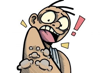 [EDITORIAL] The threat of monkeypox