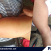 Hand, Foot, and Mouth Disease downs 52 children in Roxas, Palawan
