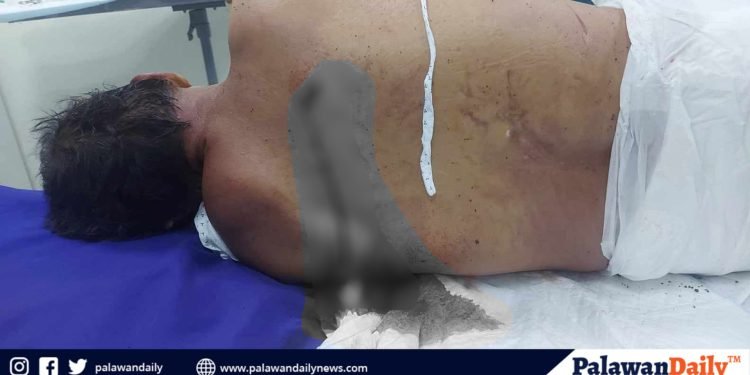Dumi ng aso, naging puno’t dulo nang saksakan sa isang purok sa lungsod