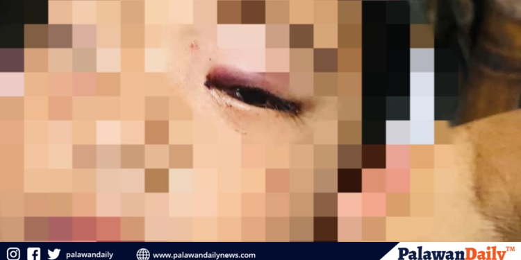 Bata, nagkaroon ng seryusong kondisyon sa mata dahil sa sobrang paggamit ng gadgets